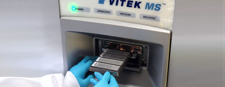 Sistema vitek - Manos colocando una muestra en el equipo VITEK MS
