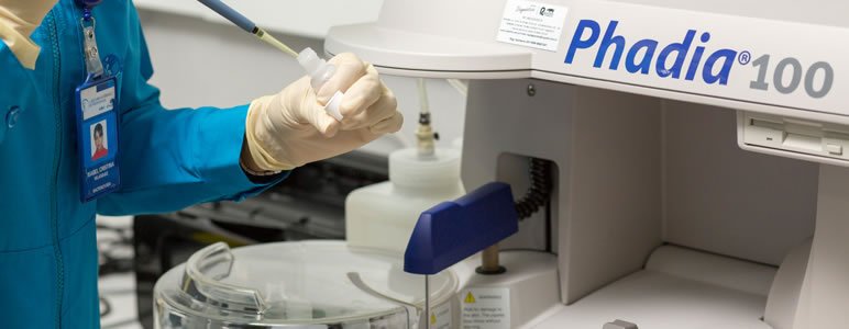 Tecnologia avanzada - Técnico de laboratorio utilizando equipo Phadia 100
