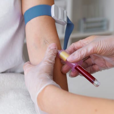 Toma de muestras - Extracción de sangre de un brazo con jeringa